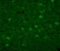 TRPC3 Antibody, Novus Biologicals:Antibodies:Primary Antibodies